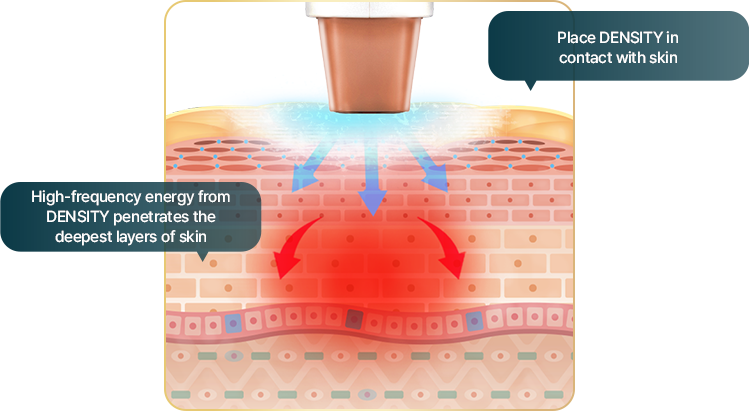 หลักการทำงานของเครื่อง DENSITY
